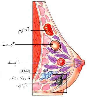 پستان در زنان و حقایقی در مورد آن