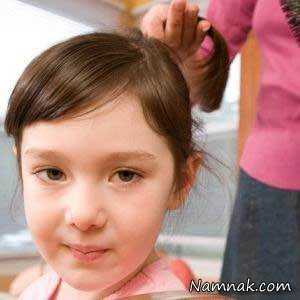 انواع ریزش مو در کودکان ، علت ریزش مو ، درمان ریزش مو
