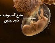 مایع دور جنین,مایع دور جنین چیست,مایع دور جنین,بارداری و زایمان علائم بارداری علائم زایمان